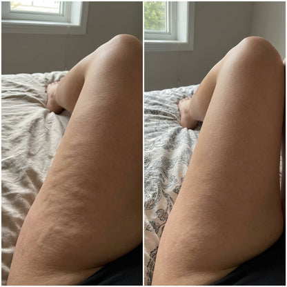 Crème aux venin d'abeille